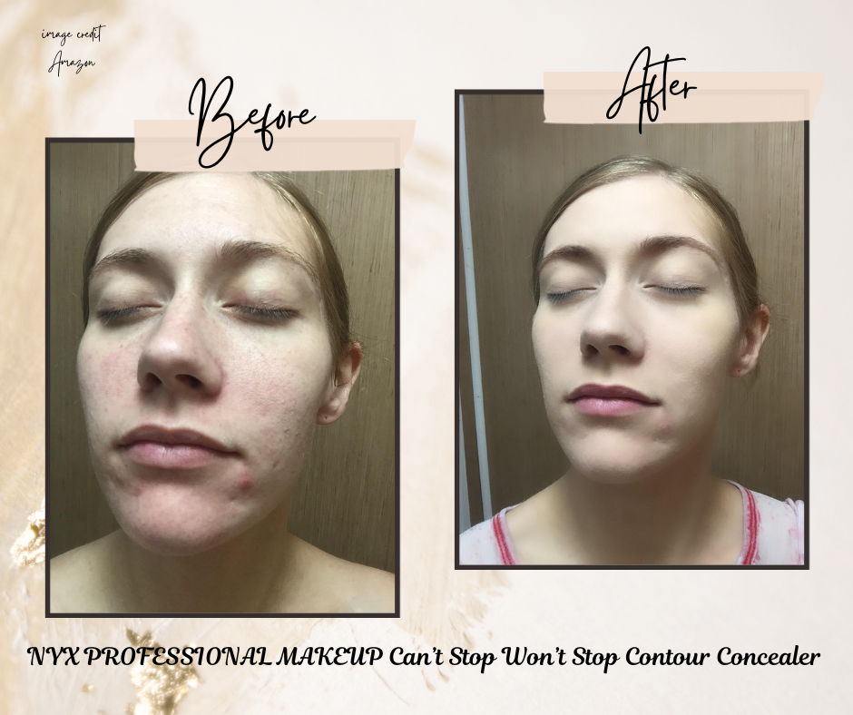  NYX PROFESSIONAL MAKEUP Can’t Stop Won’t Stop Contour Concealer before and after result
